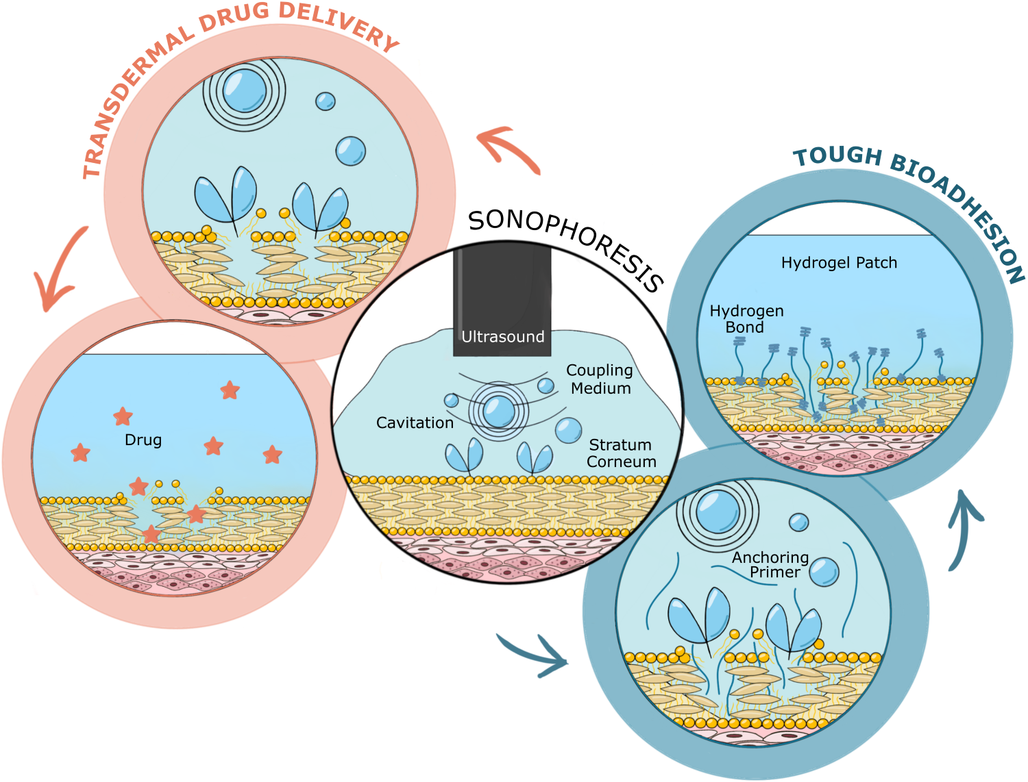 Schematic of sonophoresis treatment, in which ultrasound is applied to the skin to increase its permeability. Cavitation, <em>i.e.</em> the formation, growth and collapse of bubbles in the coupling medium applied to the skin for ultrasound transmission, is the main mechanism responsible for micro-damage of the stratum corneum. This allows the barrier effects of the stratum corneum to be overcome, facilitating the penetration of drugs into the skin in transdermal drug delivery applications (<em>left</em>), and/or the propulsion and anchoring of primers in the skin, resulting in a spatially confined, tough adhesion between a hydrogel patch and the skin (<em>right</em>).